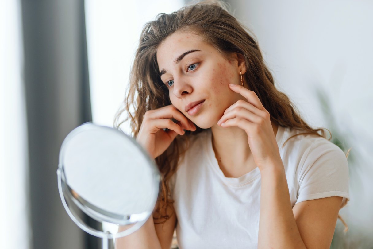Young woman looking at rash on her face in a vanity mirror