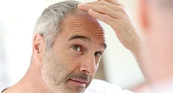 Balding man