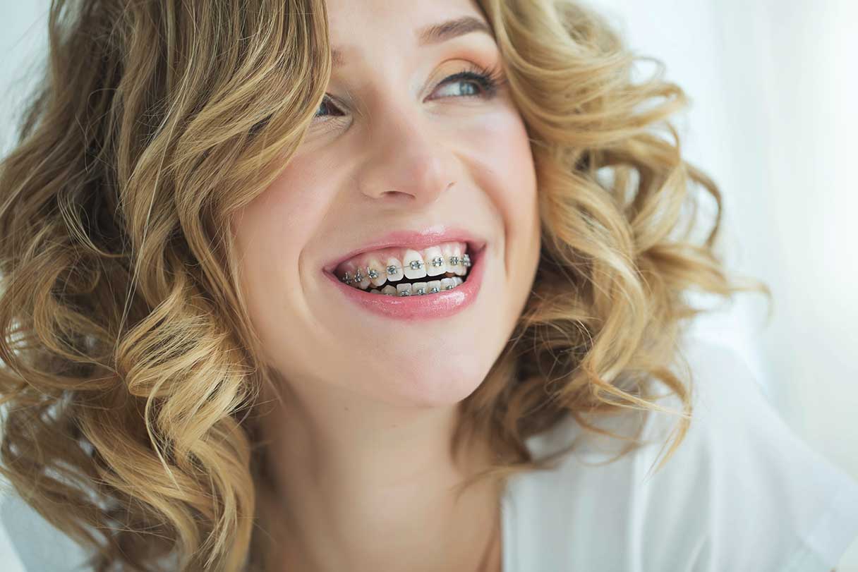 Smiling woman with braces on her teeth
