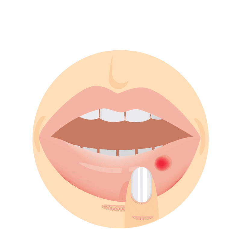 Oral Health in The Winter: 8 Dental Problems You Can Avoid