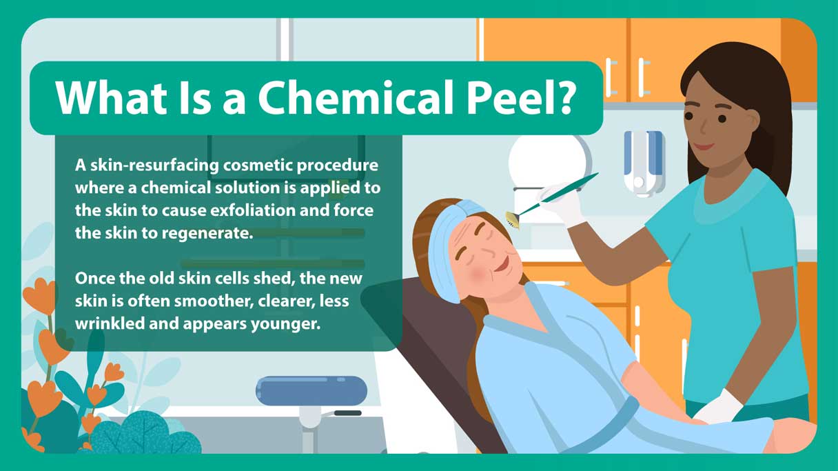What is a chemical peel?