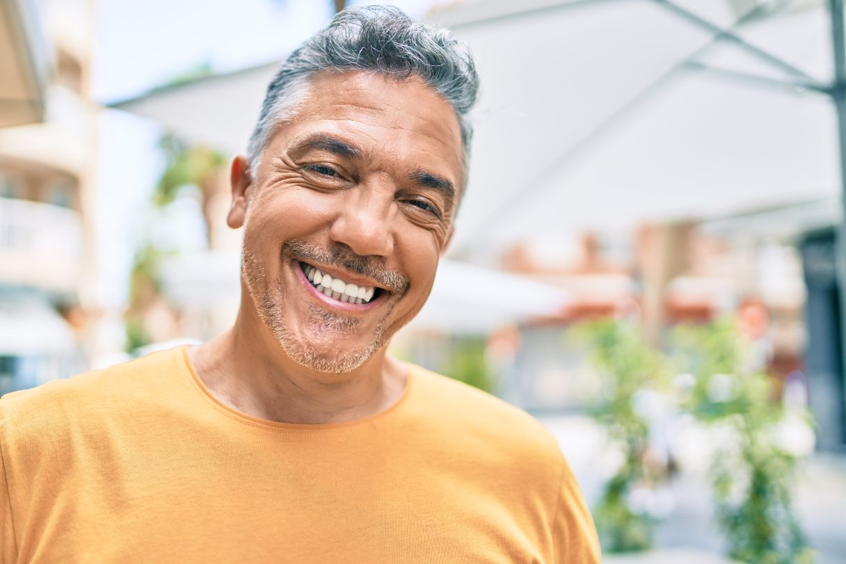 What Is a Smile Makeover and How Much Does It Cost?