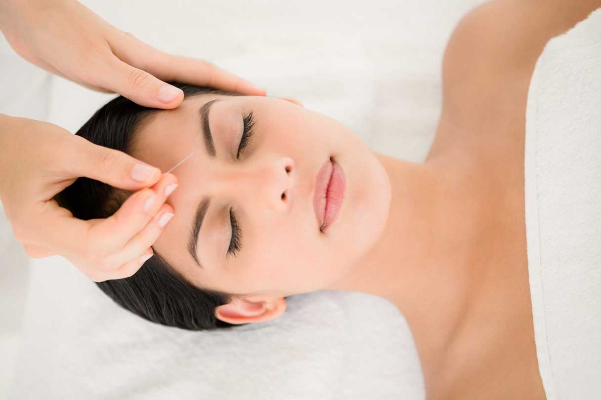 Woman receiving acupuncture service
